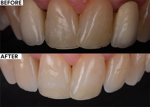 Patient-centered dentistry - before and after