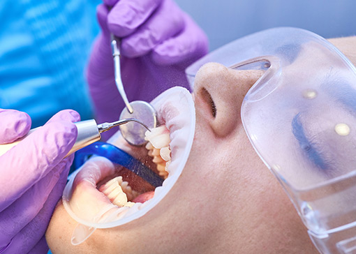 Dental procedure producing aerosols