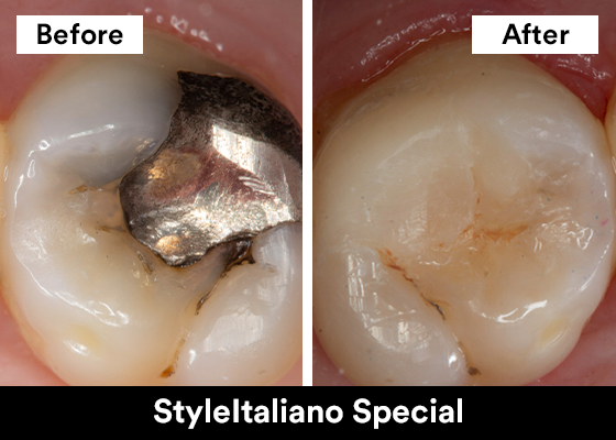 StyleItaliano Special Before and After