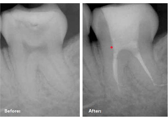 before and after