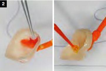 HF etching of bonding surface and priming with  3M™ Scotchbond™ Universal Plus Adhesive as silane on tooth piece