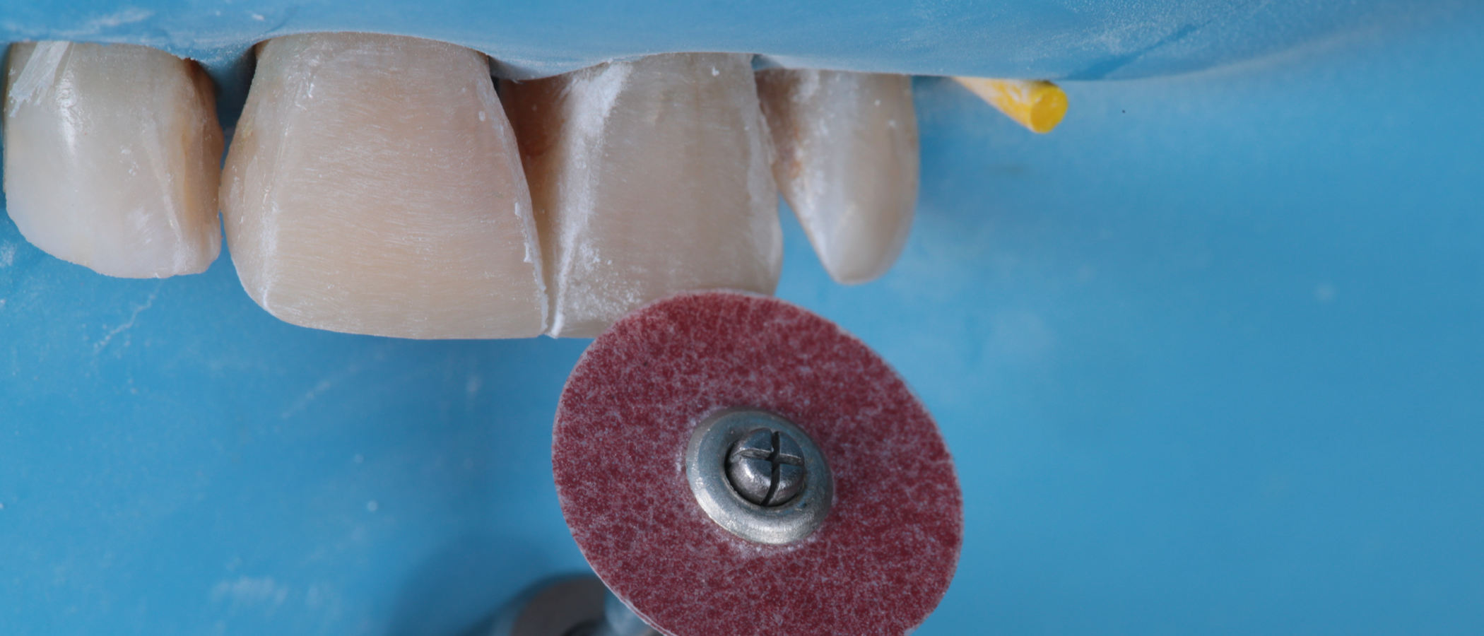 3M™ Sof-Lex™ XT Contouring and