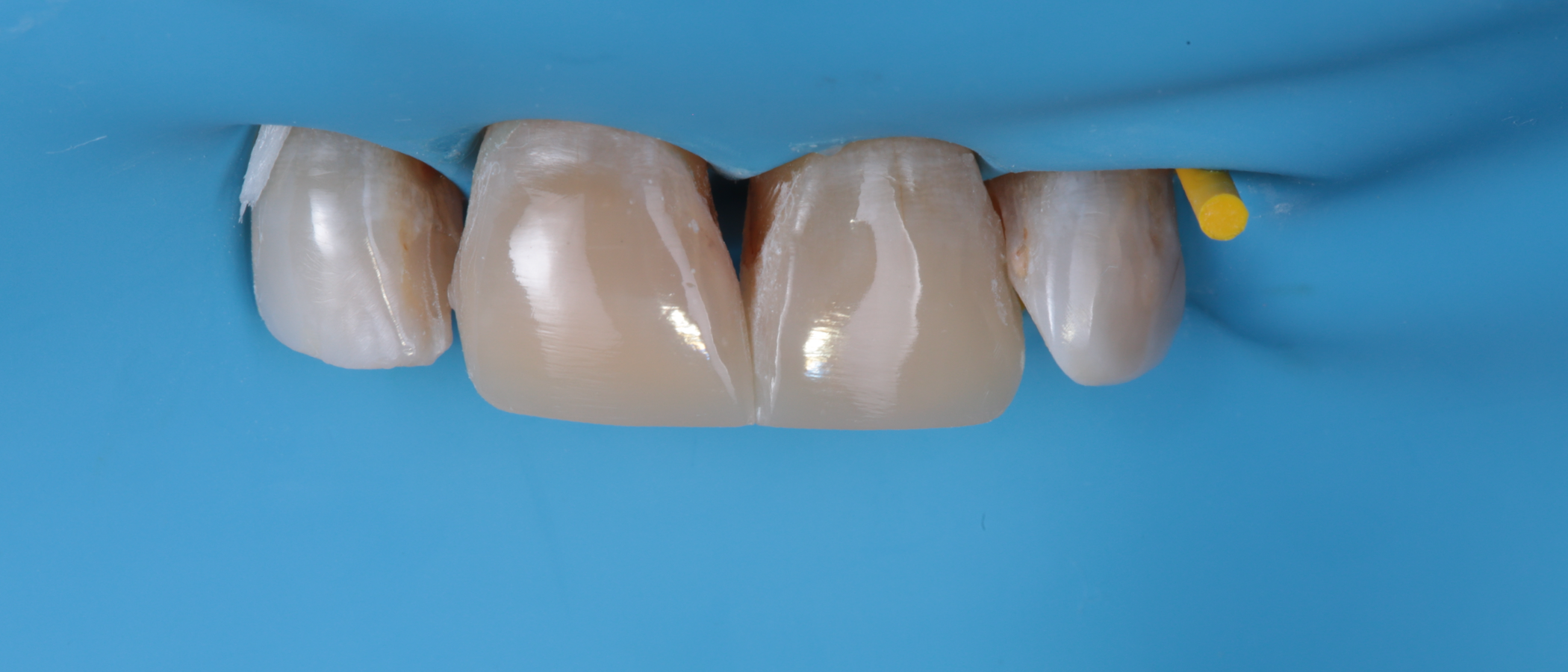 Result after polishing