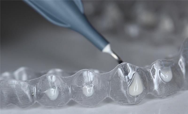 Aligner close-up