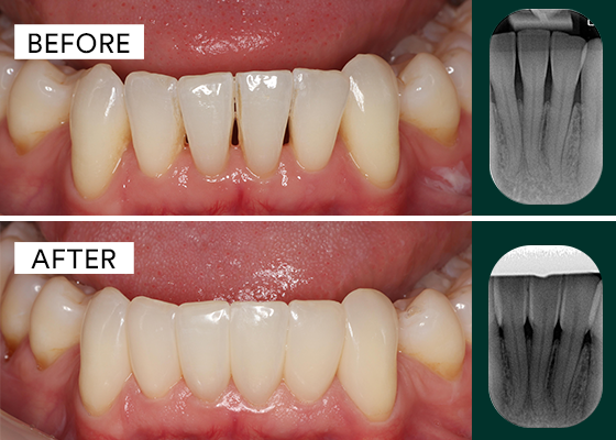before and after