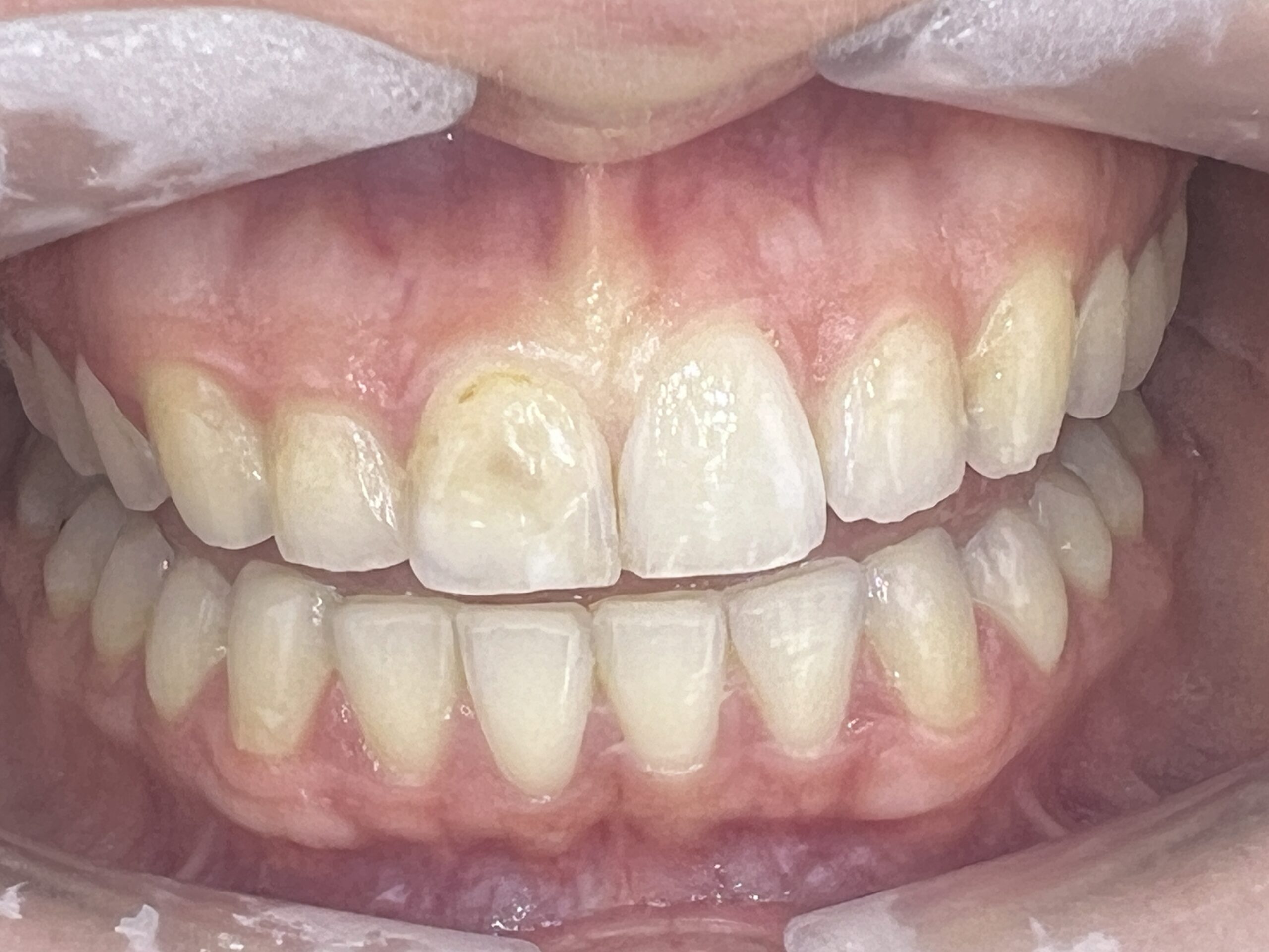 Clinical situation before 