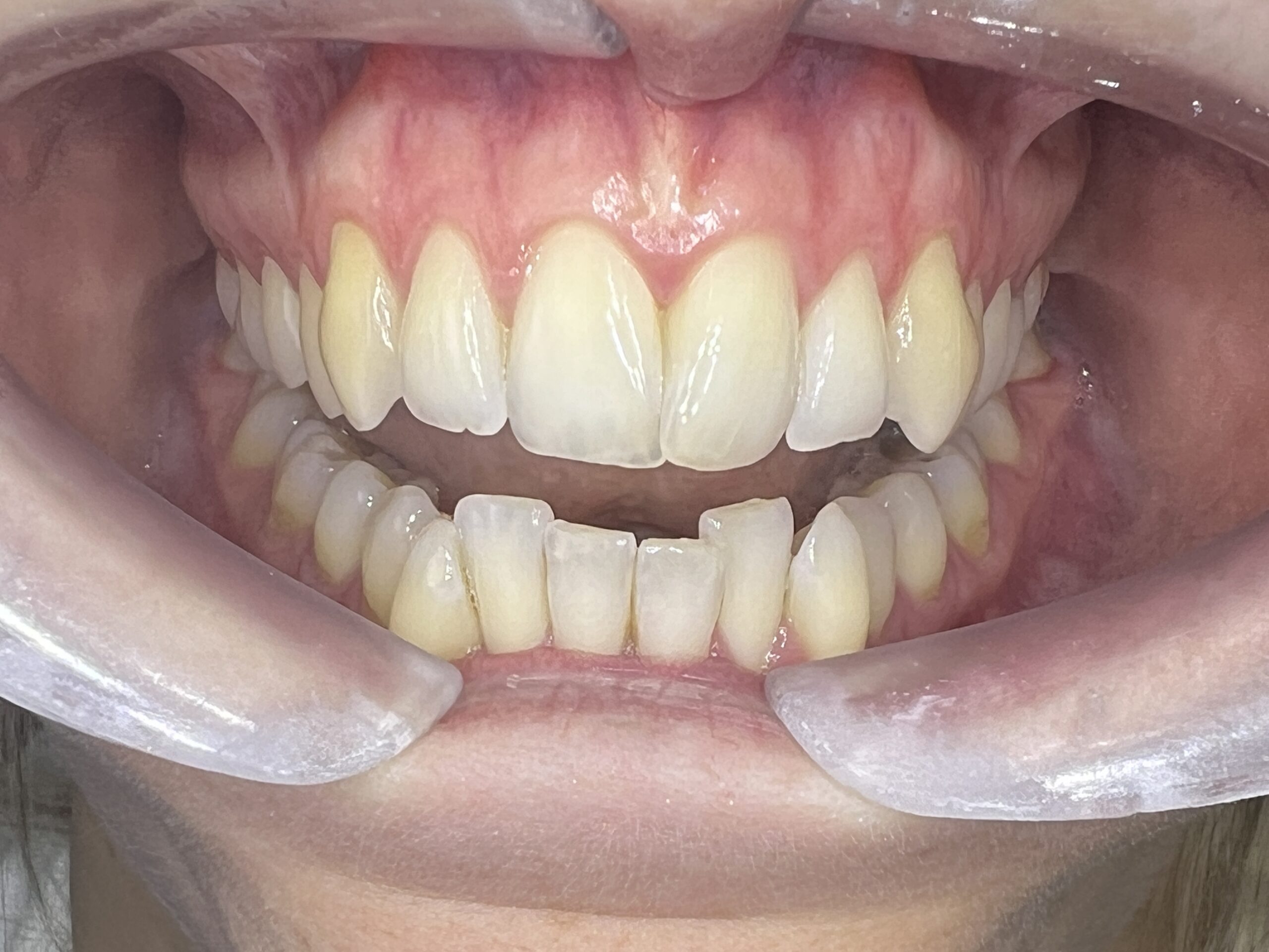 Clinical situation before