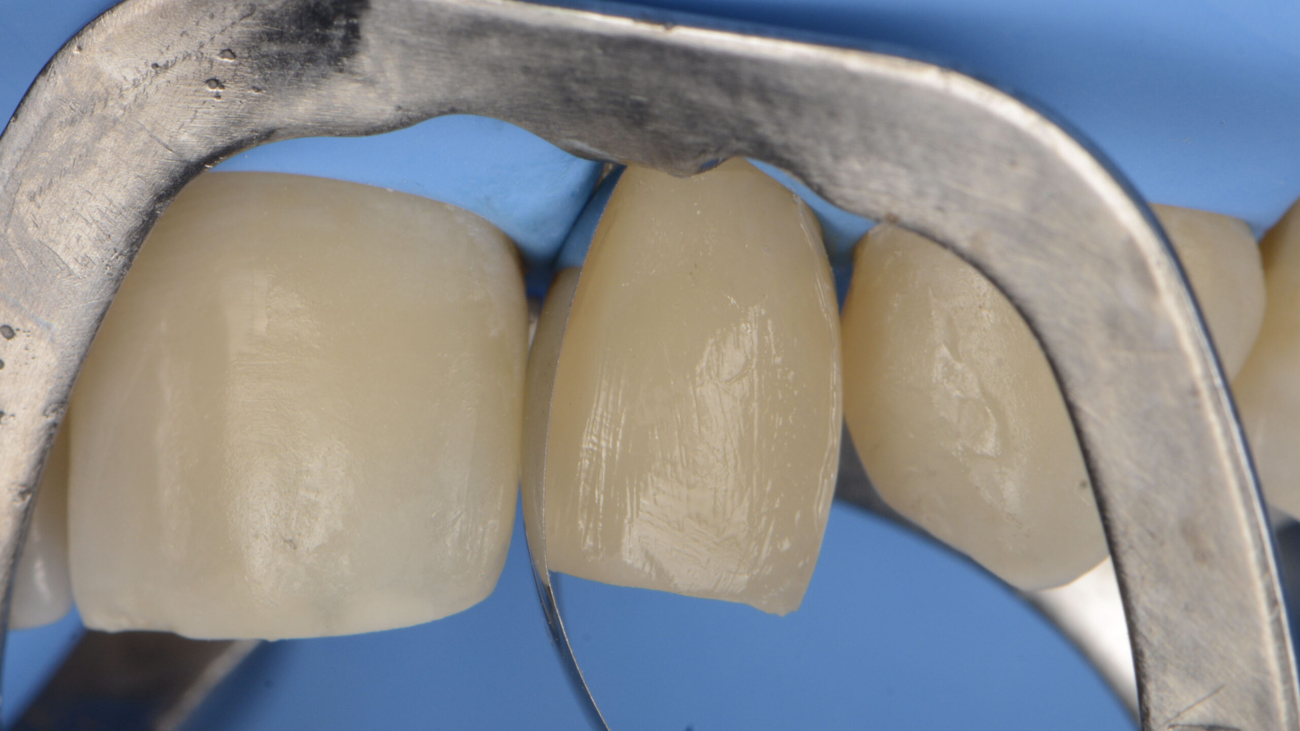 Teeth close-up