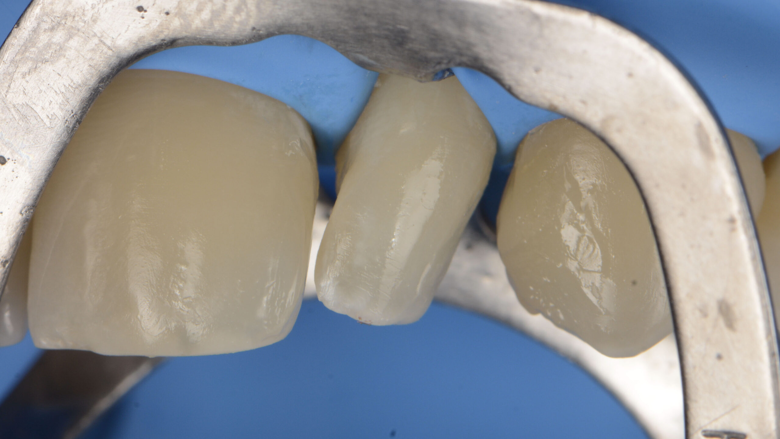 Teeth close-up