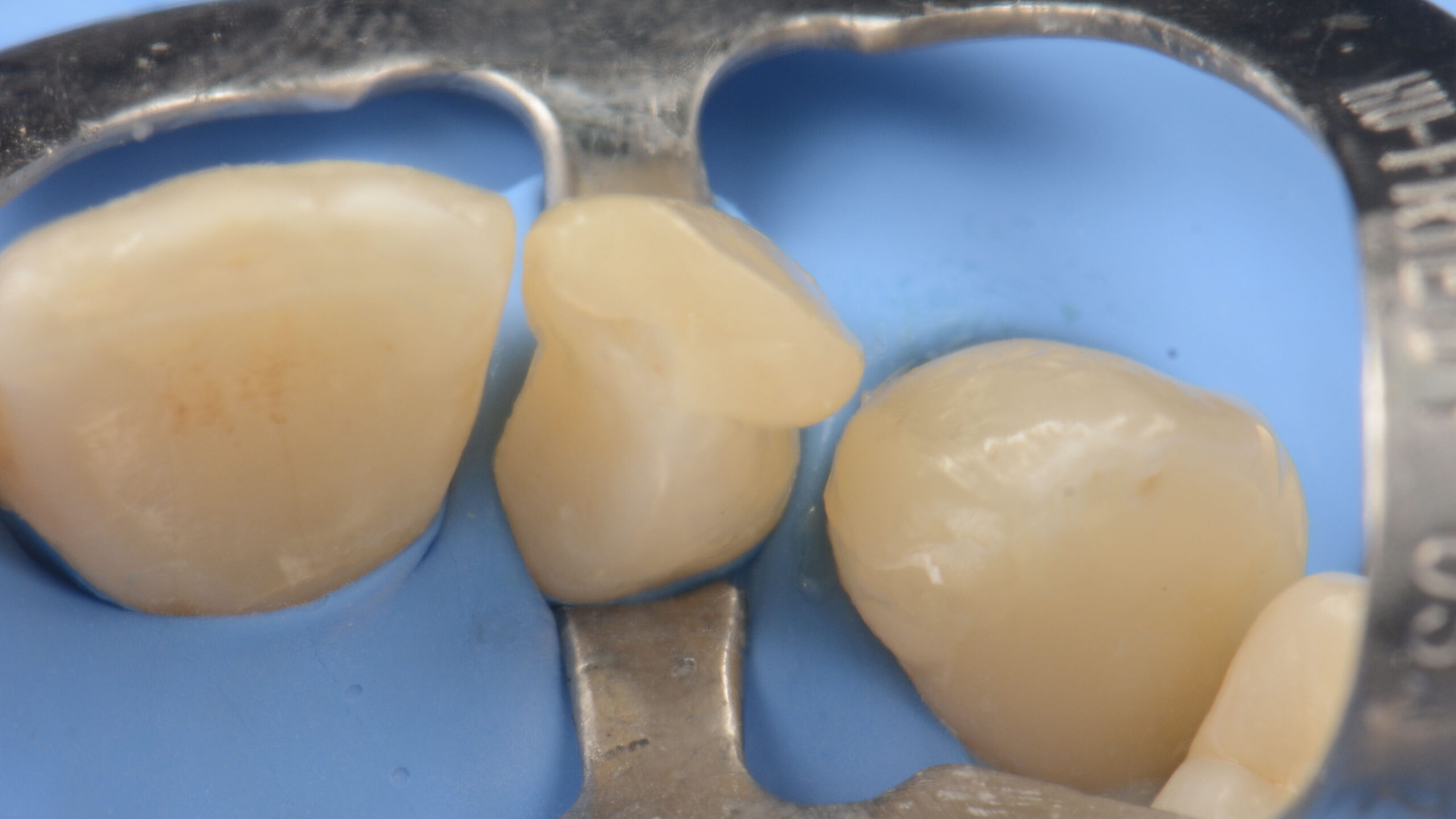 Teeth close-up from top view