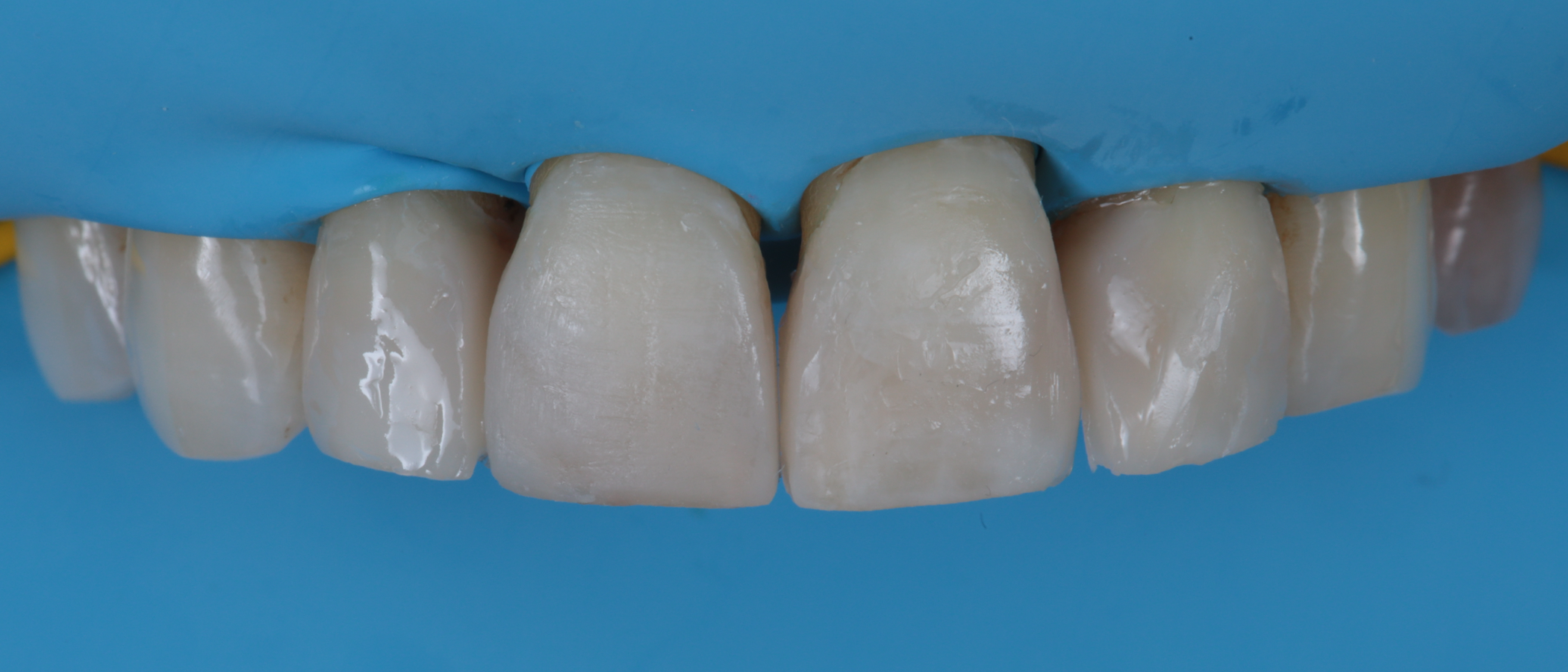 Final result before finishing and polishing